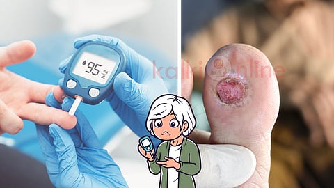 Diabetic symptoms leg skin turning in to black