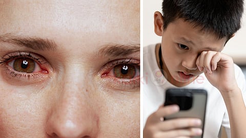 Red eyes and hone addiction