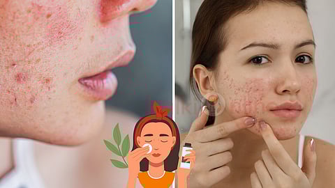skin problem and remedies