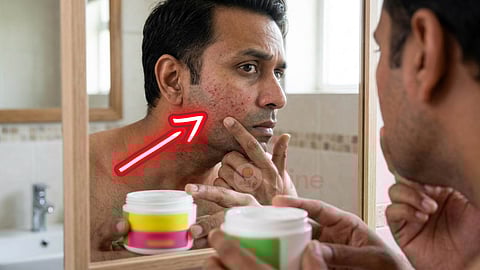 understanding-mens-skin