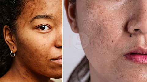 skin-brightening-tips