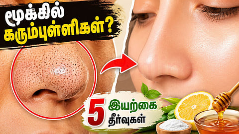 Natural Remedies for Blackheads