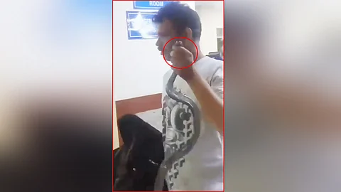 Rajasthan Man Walks Into Hospital Holding Huge Snake