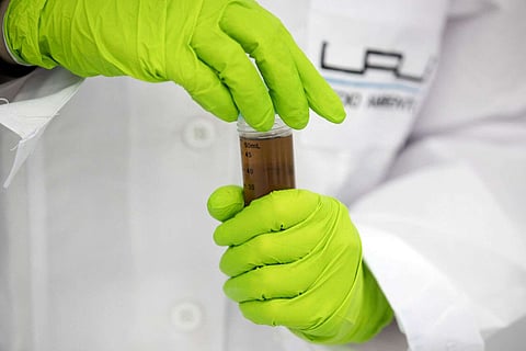 الملابس الضيقة يمكن أن تحبس الرطوبة وتسبب تهيج مجرى البول