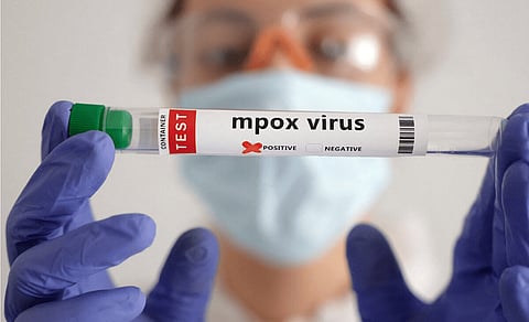 فيروس جدري القردة في باكستان: إغلاق لمدة 12 يوماً في منطقة خيبر