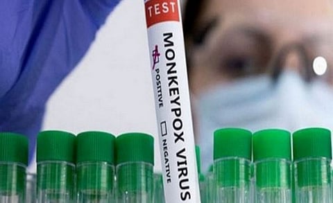 குரங்கு அம்மை பாதிப்பைக் கண்டறிய இந்தியாவிலேயே உருவாக்கப்பட்ட ஆர்.டி.பி.சி.ஆர் கிட்