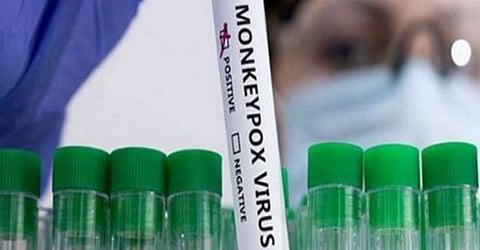 இந்தியாவின் முதல் குரங்கு அம்மை தொற்று: மத்திய அரசு முக்கியத் தகவல்