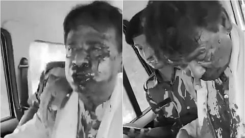 மேற்கு வங்கம்: பாஜக எம்.பி. மீது ரத்தம் வரும் அளவுக்குக் கடும் தாக்குதல்! (வீடியோ) | BJP MP Khagen Murmu |