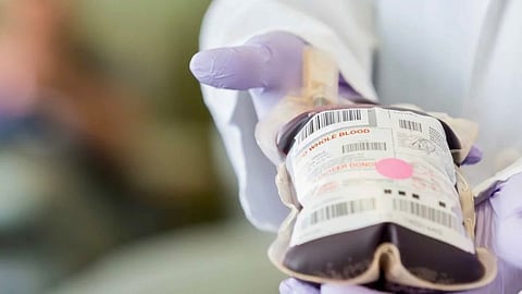 Knocksense Shorts| UP launches free blood transfusion facility for pregnant women