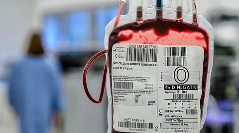 Knocksense Shorts | A new blood storage unit now operational at CHC Kalyanpur, Kanpur