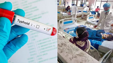 Knocksense Shorts | Doctors stress vaccination to curb spread of typhoid cases in Lucknow