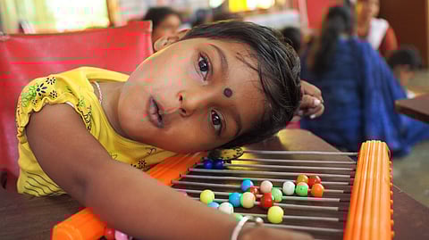 Empowering disabled children through free Surgical Camp in Indore