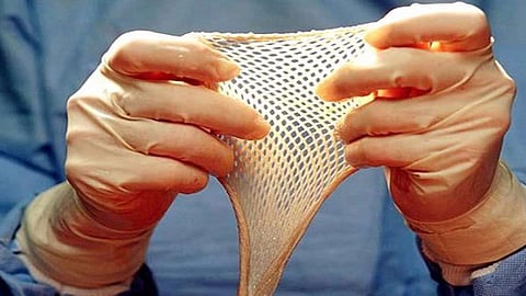 Knocksense Shorts| Ahmedabad's first government-run Skin Bank now operational at Civil Hospital