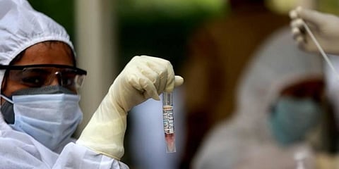 Lucknow Coronavirus news: Steepest single-day rise, 196 cases reported