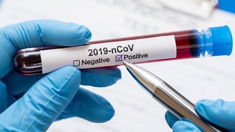 831 new Coronavirus cases recorded in Lucknow. Total testing reaches 1.1 lakh mark!