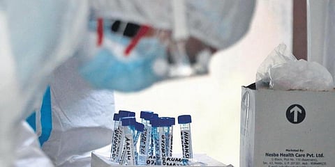 Rajasthan prepares for increased COVID-19 testing in all state districts with 2 Cobas-8800 machines