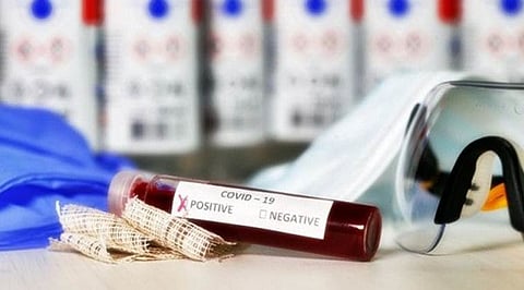 Indore reports its highest tally of 419 new Coronavirus cases in 24 hours
