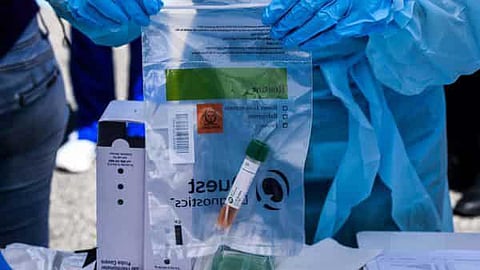 UP becomes self-reliant in fight against Covid-19; develops pharma & other resources locally