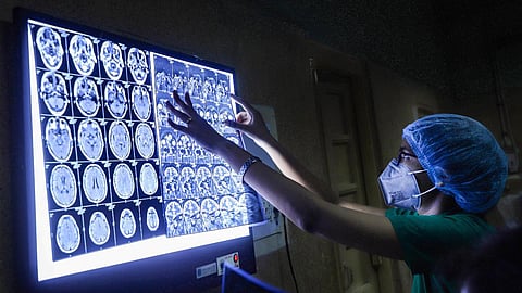 Black fungus tagged as a "notified disease" in Lucknow & other Uttar Pradesh districts!