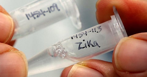 Amid rising Zika Virus Cases in UP, advisory issued for hospitals in Lucknow