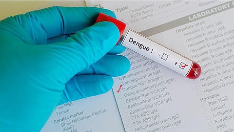 No respite from dengue in Lucknow as 11 more test positive on Thursday