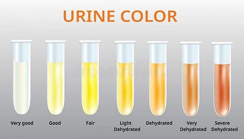 Urine color