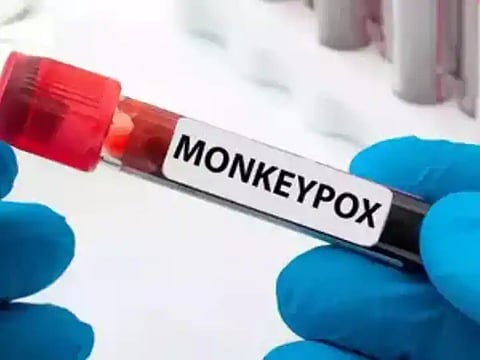 Monkeypox Case | Monkeypox Virus | Monkeypox