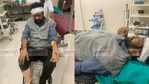 आमदार बच्चू कडू यांचा अपघात; स्वत:च दिली तब्येतीची माहिती, केले 'हे' आवाहन