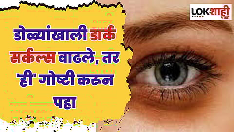 Dark Circles : डोळ्यांखाली डार्क सर्कल्स वाढले, तर 'ही' गोष्टी करून पहा