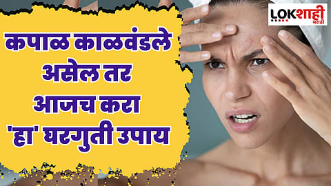Forehead Tanning Home Remedy : कपाळ काळवंडले असेल तर आजच करा 'हा' घरगुती उपाय; सर्व टॅनिंग जाईल निघून