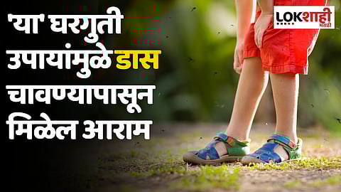 Mosquito Bite: डास चावल्याने होते जळजळ; 'या' घरगुती उपायांमुळे मिळेल त्वरीत आराम