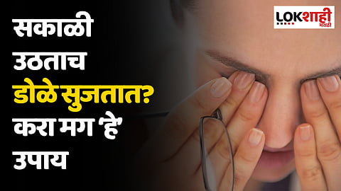 Eye Swelling : सकाळी उठताच सुजतात डोळे ? करा मग हे उपाय