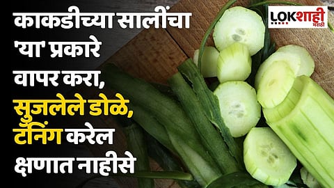 काकडीच्या सालींचा 'या' प्रकारे वापर करा, सुजलेले डोळे आणि टॅनिंग करेल क्षणात नाहीसे