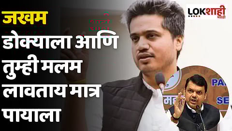 Rohit Pawar On Devendra Fadnavis : जखम डोक्याला आणि तुम्ही मलम लावताय मात्र पायाला