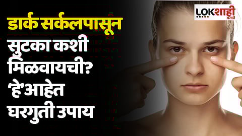 Dark Circles पासून सुटका कशी मिळवायची? ‘हे’आहेत घरगुती उपाय