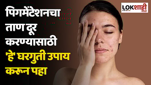 पिगमेंटेशनचा ताण दूर करण्यासाठी 'हे' घरगुती उपाय करून पहा