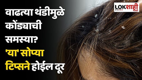 वाढत्या थंडीमुळे कोंड्याची समस्या? 'या' सोप्या टिप्सने होईल दूर