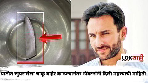 Saif Ali Khan stabbed in the back
