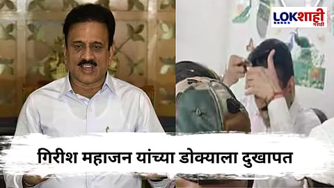 जलसंपदा मंत्री गिरीश महाजन यांच्या डोक्याला गंभीर दुखापत ; रक्तस्राव सुरु पण...