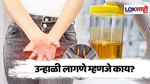 Urinary Tract Infections : उन्हाळी लागणे म्हणजे काय? जाणून घ्या काळजी कशी घ्यावी