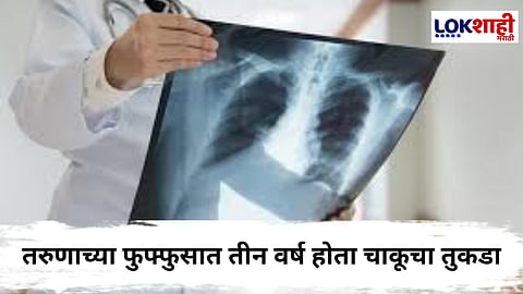 भयंकर! ओडिशातील एका व्यक्तीच्या फुफ्फुसात सापडला 8 सेमीचा चाकू; तीन वर्षांनी झाली शस्त्रक्रिया