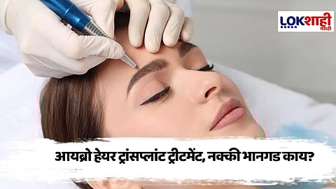 Eyebrow Hair Transplant : मराठी सिनेसृष्टीमधील 'या' नायिकांचा आयब्रो हेअर ट्रान्सप्लांटकडे कल; कोणत्या आहेत त्या जाणून घ्या?