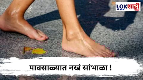 Rainy Season : पावसाळ्यात नखांची अशी घ्या काळजी !