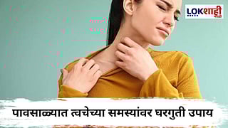 Monsoon Tips : पावसाळ्यात दमट कपड्यांमुळे त्वचेला खाज आणि रॅश येतात? मगं 'हे' घरगुती उपाय ट्राय करा