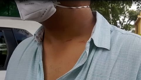 शिवसेनेच्या माजी खासदाराच्या पुतण्याची डॉक्टरला मारहाण; शहरातील रुग्णालये, लसीकरण केंद्र बंद