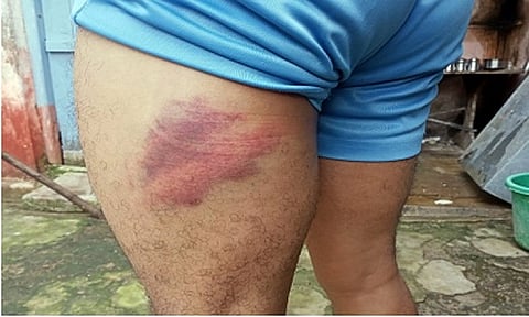 गडचिरोली जिल्ह्यात दोन वनरक्षकांना नक्षल्यांकडून बेदम मारहाण