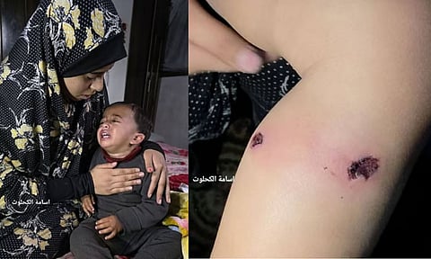 ஒரு காலில் சிகரெட், ஒரு காலில் ஆணி: போருக்கு விலைகொடுத்த 18 மாதக்குழந்தை... தந்தை கண்முன்னே அரங்கேறிய கொடூரம்!