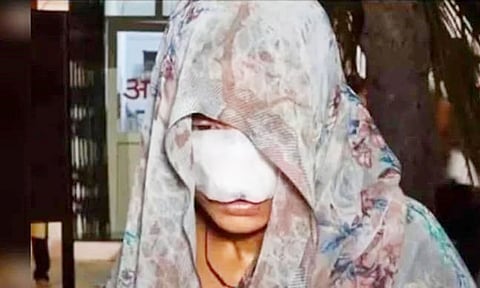 உத்தரபிரதேசத்தில் பயங்கரம்: குடும்ப தகராறில் மனைவியின் மூக்கை கடித்து துப்பிய கணவர்