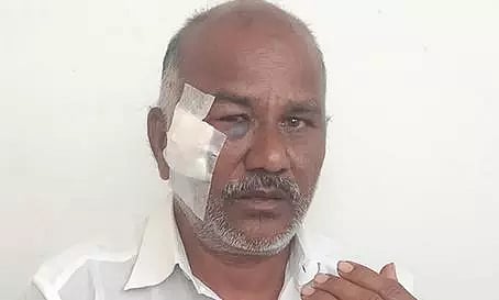 முகமூடி கும்பலால் தாக்கப்பட்ட குணசேகரன்.