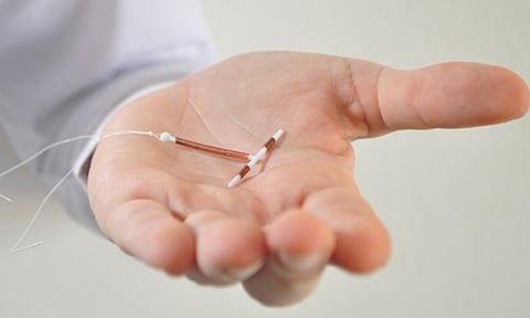 கர்ப்பமடைவதை தடுக்கும் நீண்ட கால கருத்தடை சாதனம்